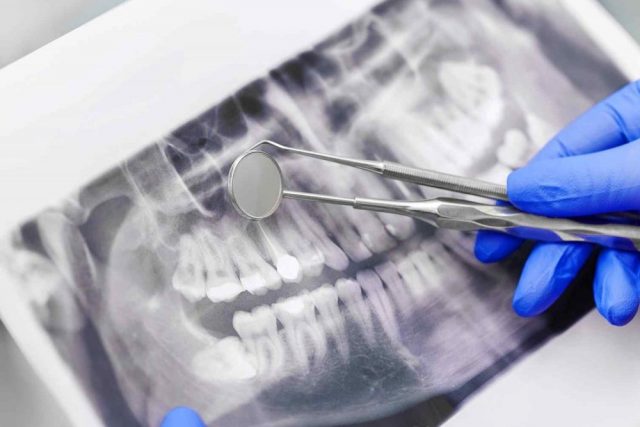 SERVICES | Quality Dental Care services SERVICES 1 640x427