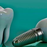 Dentists in Brighton | Quality Dental Care in Brighton | Adelaide, South Australia dental implants Types of Dental Implants | Quality Dental Care | Adelaide, South Australia qdc 13 1 1 160x160